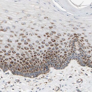 Anti-TBC1D10A antibody produced in rabbit Prestige Antibodies&#174; Powered by Atlas Antibodies, affinity isolated antibody, buffered aqueous glycerol solution