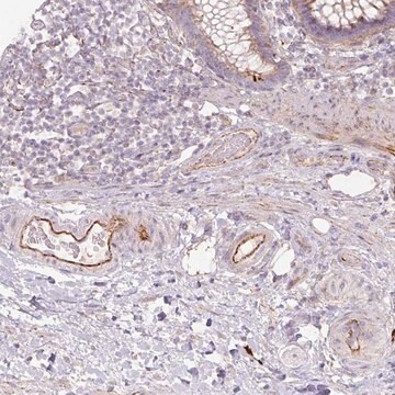 Anti-CCNI2 antibody produced in rabbit Prestige Antibodies&#174; Powered by Atlas Antibodies, affinity isolated antibody, buffered aqueous glycerol solution