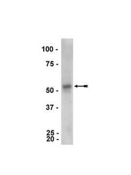 Przeciwciało anty-Parkin, klon PRK8 ascites fluid, clone PRK8, Upstate&#174;