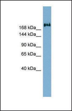 Anti-TMEM2 antibody produced in rabbit affinity isolated antibody