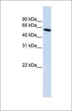 Anti-PDLIM5 (ab1) antibody produced in rabbit affinity isolated antibody