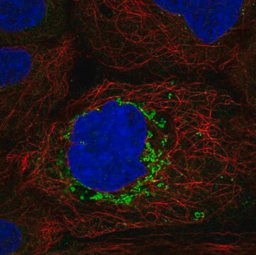 Anti-ABHD10 antibody produced in rabbit Prestige Antibodies&#174; Powered by Atlas Antibodies, affinity isolated antibody