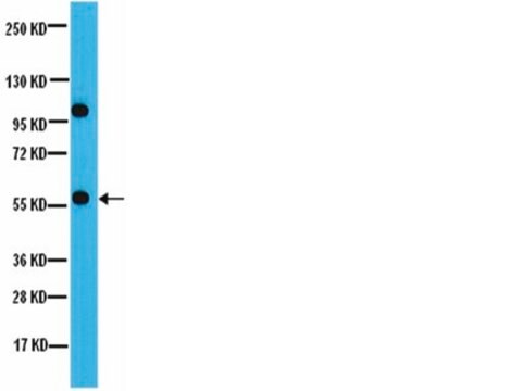 Anti-PP2A-B’ (B56) Antibody from rabbit | Sigma-Aldrich