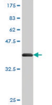 Monoclonal Anti-CENPJ antibody produced in mouse clone 1A5, purified immunoglobulin, buffered aqueous solution