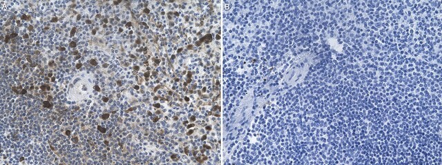 Anti-CD43 Antibody, clone 1O6 ZooMAb&#174; Rabbit Monoclonal recombinant, expressed in HEK 293 cells