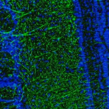 Anti-DPP6 antibody produced in rabbit Prestige Antibodies&#174; Powered by Atlas Antibodies, affinity isolated antibody, buffered aqueous glycerol solution