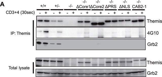 Anti-Themis Antibody from rabbit, purified by affinity chromatography