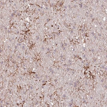 Anti-TTC1 antibody produced in rabbit Prestige Antibodies&#174; Powered by Atlas Antibodies, affinity isolated antibody, buffered aqueous glycerol solution