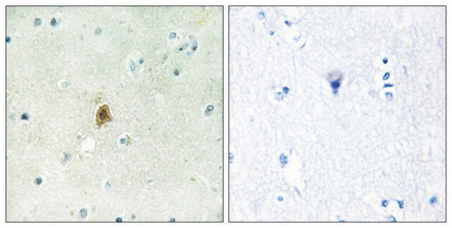 Anti-TAF15 antibody produced in rabbit affinity isolated antibody