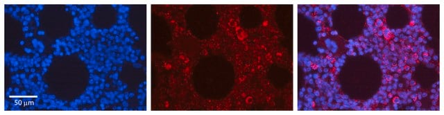 Anti-EPOR antibody produced in rabbit affinity isolated antibody