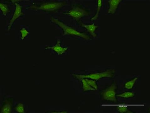 Monoclonal Anti-ARMET antibody produced in mouse clone 1D10, purified immunoglobulin, buffered aqueous solution