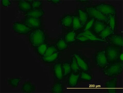 Monoclonal Anti-SGK2 antibody produced in mouse clone 4G4, purified immunoglobulin, buffered aqueous solution