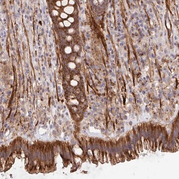 Anti-TM9SF4 antibody produced in rabbit Prestige Antibodies&#174; Powered by Atlas Antibodies, affinity isolated antibody, buffered aqueous glycerol solution