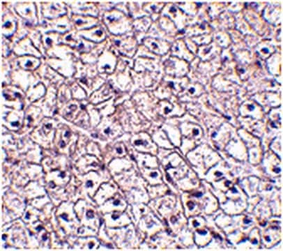 Anti-TSLP receptor Antibody from rabbit, purified by affinity chromatography