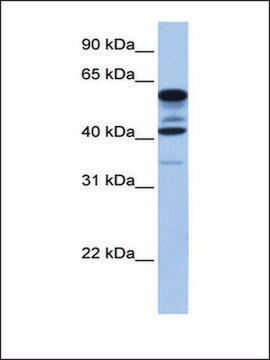 Anti-FAM46C antibody produced in rabbit affinity isolated antibody