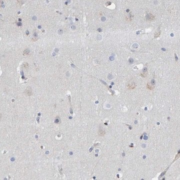 Anti-MMP16 antibody produced in rabbit Prestige Antibodies&#174; Powered by Atlas Antibodies, affinity isolated antibody, buffered aqueous glycerol solution