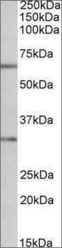 Anti-CASP3 antibody produced in goat affinity isolated antibody, buffered aqueous solution