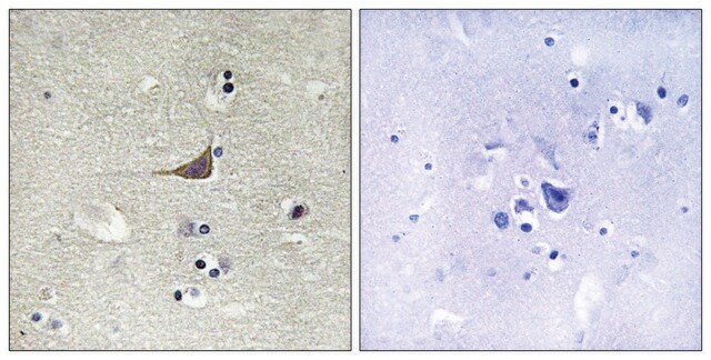 Anti-GPR180 antibody produced in rabbit affinity isolated antibody