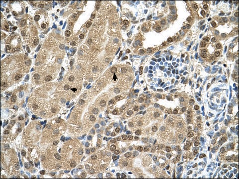 Anti-TBX15 antibody produced in rabbit IgG fraction of antiserum