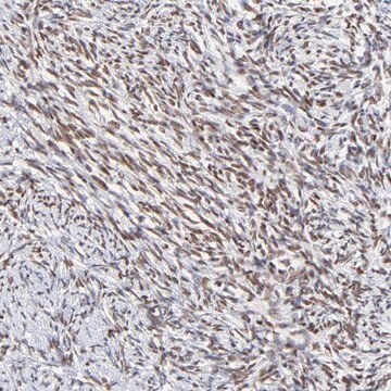 Anti-ZNF74 antibody produced in rabbit Prestige Antibodies&#174; Powered by Atlas Antibodies, affinity isolated antibody, buffered aqueous glycerol solution