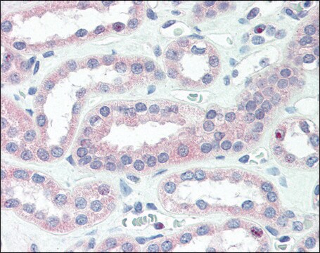 Anti-CRLF2 antibody produced in rabbit affinity isolated antibody