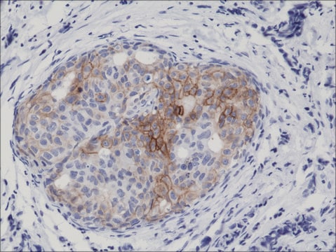 Anti-Phospho-EGFR (y1173) antibody, Rabbit monoclonal recombinant, expressed in HEK 293 cells, clone RM269, purified immunoglobulin