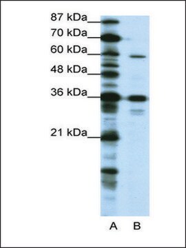 Anti-CREB3L1 (AB2) antibody produced in rabbit IgG fraction of antiserum