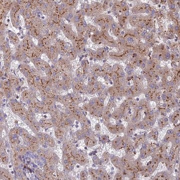 Anti-ST3GAL6 antibody produced in rabbit Prestige Antibodies&#174; Powered by Atlas Antibodies, affinity isolated antibody, buffered aqueous glycerol solution