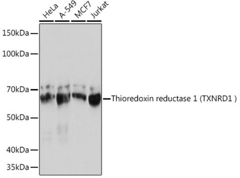 Anti-Thioredoxin reductase 1 (TXNRD1 ) Antibody, clone 7P1J4, Rabbit Monoclonal