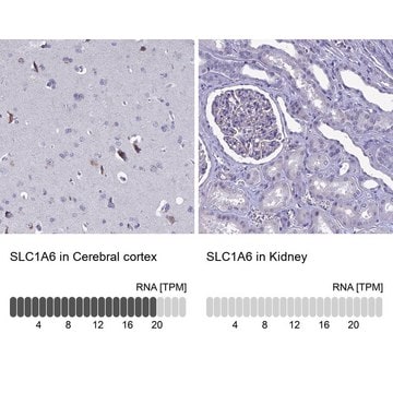 Anti-SLC1A6 antibody produced in rabbit Prestige Antibodies&#174; Powered by Atlas Antibodies, affinity isolated antibody, buffered aqueous glycerol solution