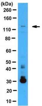 Anti-OFD1 Antibody from rabbit, purified by affinity chromatography