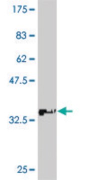 Monoclonal Anti-ATP7B antibody produced in mouse clone 3E10, purified immunoglobulin, buffered aqueous solution