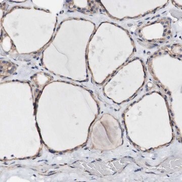 Anti-LRIG3 antibody produced in rabbit Prestige Antibodies&#174; Powered by Atlas Antibodies, affinity isolated antibody, buffered aqueous glycerol solution