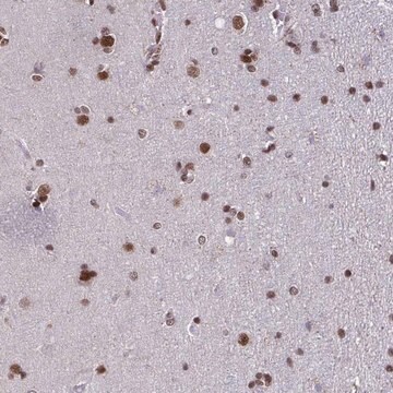 Anti-TIMM21 antibody produced in rabbit Prestige Antibodies&#174; Powered by Atlas Antibodies, affinity isolated antibody, buffered aqueous glycerol solution