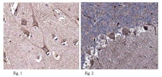 Anti-Neurotrypsin Antibody from rabbit, purified by affinity chromatography