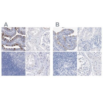 Anti-C1orf87 antibody produced in rabbit Prestige Antibodies&#174; Powered by Atlas Antibodies, affinity isolated antibody, buffered aqueous glycerol solution