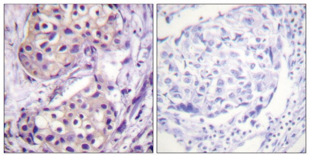 Anti-IKK-&#946; antibody produced in rabbit affinity isolated antibody