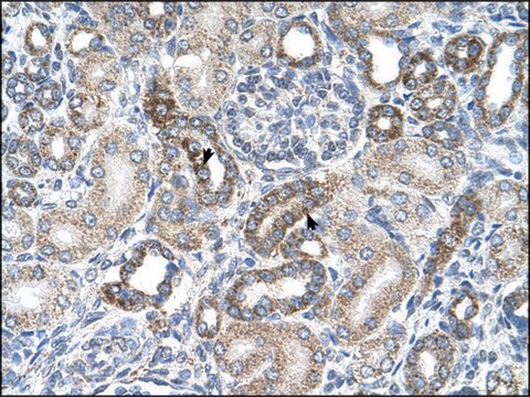 Anti-UST antibody produced in rabbit IgG fraction of antiserum