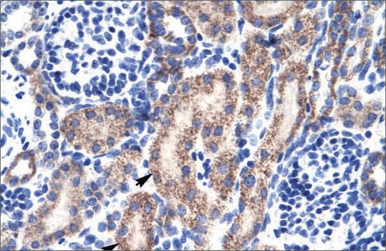 Anti-RBAK antibody produced in rabbit affinity isolated antibody