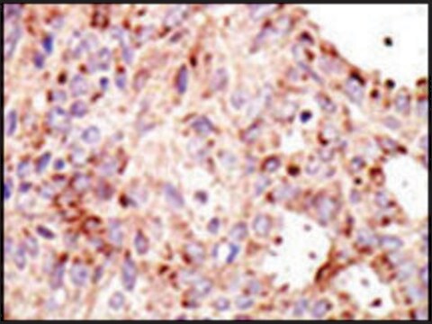 Anti-ARF4L (C-term) antibody produced in rabbit IgG fraction of antiserum, buffered aqueous solution