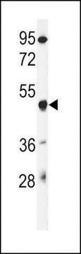 ANTI-GSDMA(N-TERMINAL) antibody produced in rabbit affinity isolated antibody, buffered aqueous solution