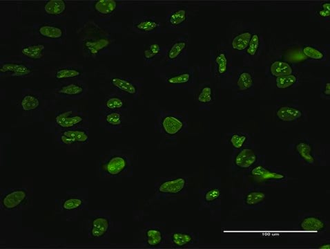 Anti-NCL antibody produced in mouse purified immunoglobulin, buffered aqueous solution