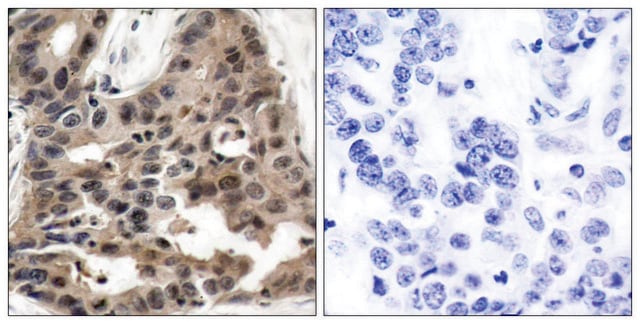 Anti-4E-BP1 antibody produced in rabbit affinity isolated antibody