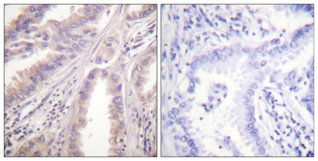 Anti-KIF11 antibody produced in rabbit affinity isolated antibody