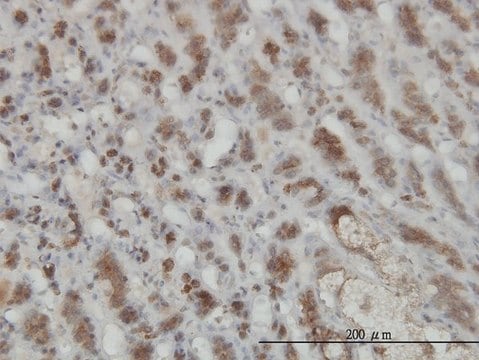 Monoclonal Anti-GMPPB antibody produced in mouse clone 2B5, purified immunoglobulin, buffered aqueous solution