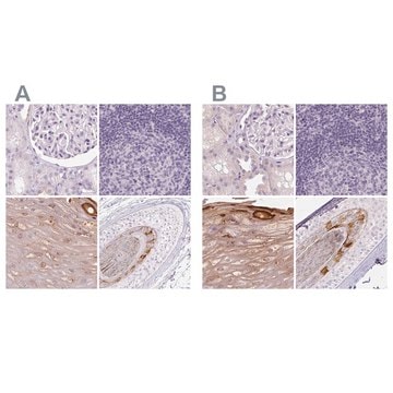 Anti-RPTN antibody produced in rabbit Prestige Antibodies&#174; Powered by Atlas Antibodies, affinity isolated antibody, buffered aqueous glycerol solution