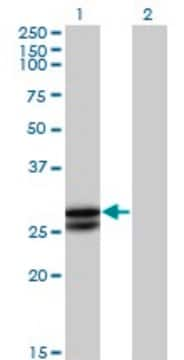 Anti-OSM antibody produced in mouse purified immunoglobulin, buffered aqueous solution