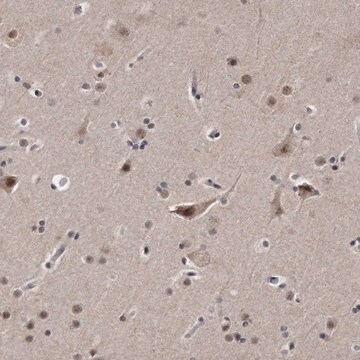 Anti-KLHDC3 antibody produced in rabbit Prestige Antibodies&#174; Powered by Atlas Antibodies, affinity isolated antibody, buffered aqueous glycerol solution, ab1