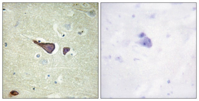 Anti-IGF2R antibody produced in rabbit affinity isolated antibody