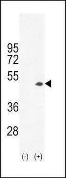 ANTI-CREATINE KINASE B(C-TERMINAL) antibody produced in rabbit IgG fraction of antiserum, buffered aqueous solution